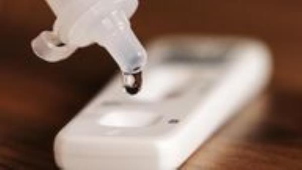 File photo dated 08/01/22 of a testing solution dripping into a Covid 19 lateral flow testing strip. Covid-19 testing should continue to be free for all to protect people at severe risk of illness if they get the virus, a group of charities has said. Issue date: Thursday February 17, 2022.