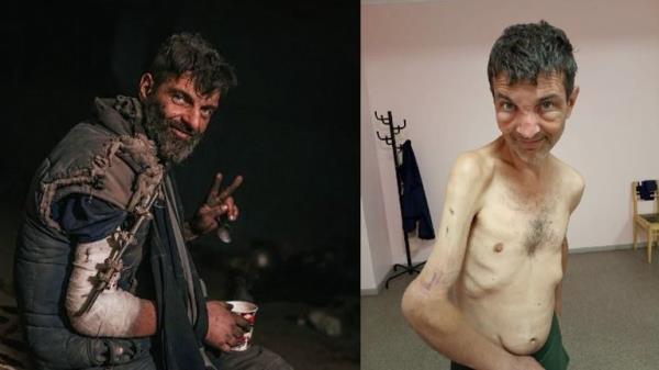 Ukrainian marine Mikhailo Dianov before and after four months as a POW under Russia troops after defending the Azovstal steel works in Mariupol 