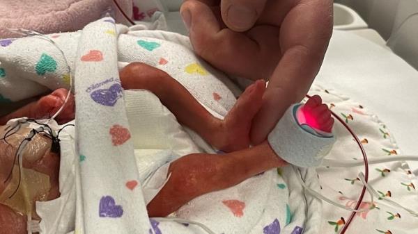 Isla - Lauren Ormston - Neonatal cost of living