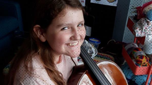 Victoria is a long COVID sufferer