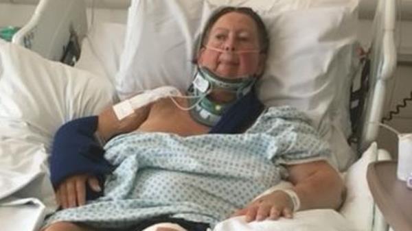 Sharon Cochrane suffered a broken leg and arm, eight broken ribs and two broken collarbones. Pic: Sharon Cochrane